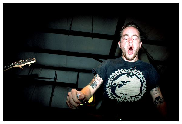 Cancer Bats